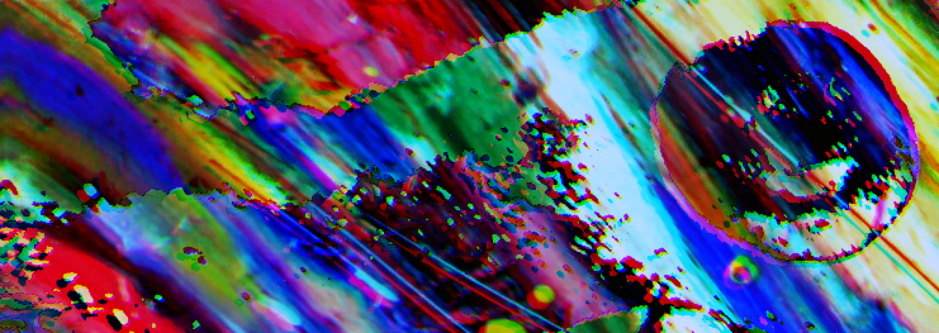 TTN